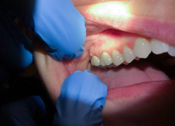 Best Pediatric Emergency Dentist in Minoa, NY