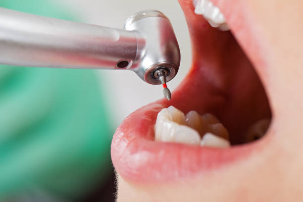 Best Emergency Treatment for Toothache in Minoa, NY